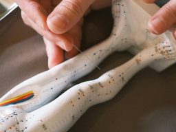 A hand inserting a needle into a model of a human arm with anatomical markings.